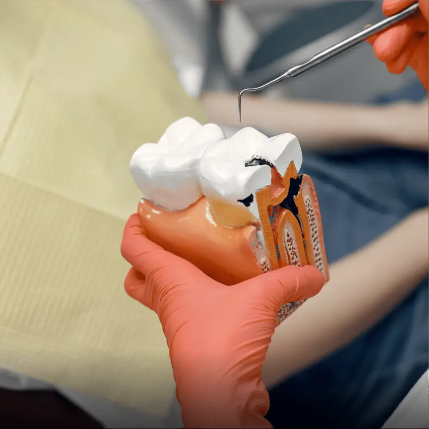 Desvitalização: quando pode ajudar a preservar um dente?