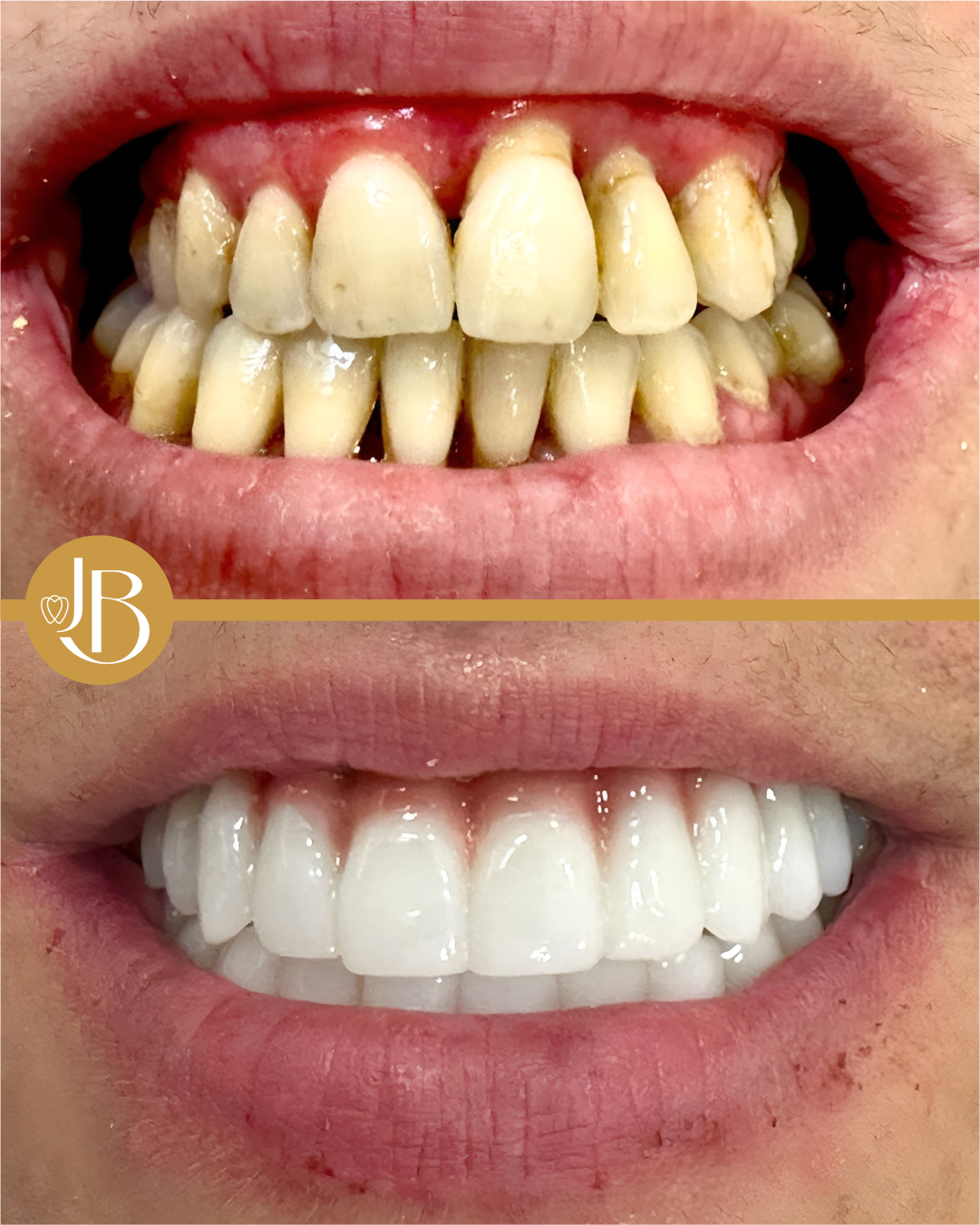 antes e depois 2