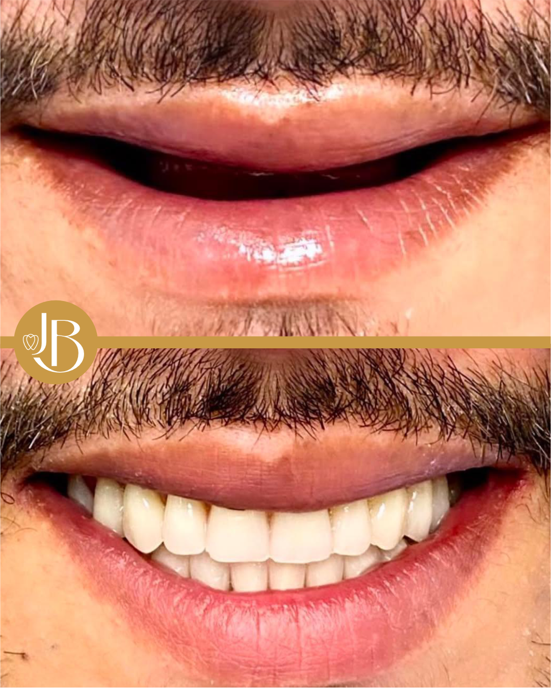 antes e depois 6